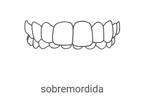 Dentes da frente superiores cobrem quase que totalmente os dentes inferiores